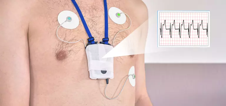 What Happens During Holter Monitor Test and its Procedure?